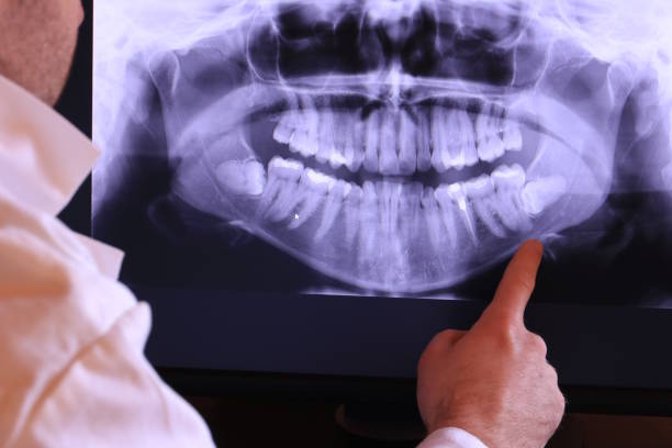 Best Emergency Treatment for Dental Infections or Abscesses in Middletown, PA
